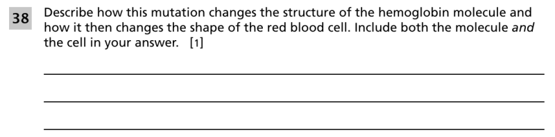 File:Sickle cell anemia 2.png